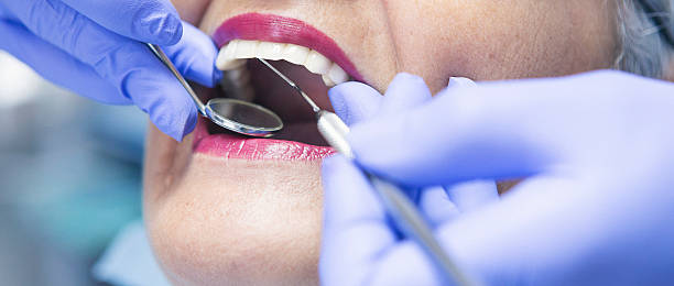 Best Emergency Dental Care for Broken or Chipped Teeth in Welsh, LA